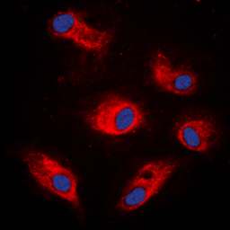 Anti-p70 S6K (phospho Ser434) antibody used in Immunocytochemistry/ Immunofluorescence (ICC/IF). GTX32352