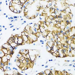 Anti-alpha 1 Catenin antibody used in IHC (Paraffin sections) (IHC-P). GTX32433