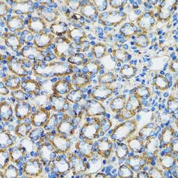 Anti-alpha 1 Catenin antibody used in IHC (Paraffin sections) (IHC-P). GTX32433