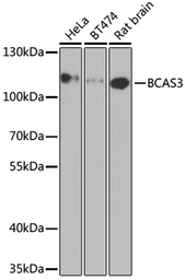 Anti-BCAS3 antibody used in Western Blot (WB). GTX32467