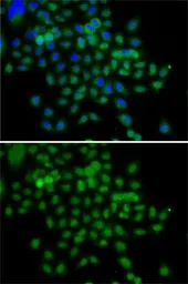 Anti-BCAS3 antibody used in Immunocytochemistry/ Immunofluorescence (ICC/IF). GTX32467