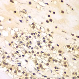 Anti-BCAS3 antibody used in IHC (Paraffin sections) (IHC-P). GTX32467