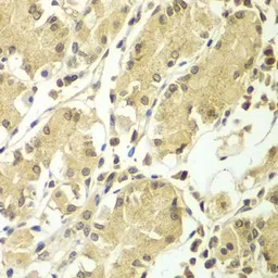 Anti-BCAS3 antibody used in IHC (Paraffin sections) (IHC-P). GTX32467