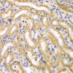 Anti-BCAS3 antibody used in IHC (Paraffin sections) (IHC-P). GTX32467