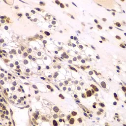 Anti-CEBP gamma antibody used in IHC (Paraffin sections) (IHC-P). GTX32514