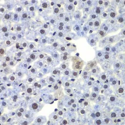 Anti-CEBP gamma antibody used in IHC (Paraffin sections) (IHC-P). GTX32514