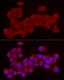 Anti-Chemerin antibody used in Immunocytochemistry/ Immunofluorescence (ICC/IF). GTX32518