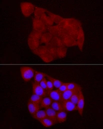 Anti-Chemerin antibody used in Immunocytochemistry/ Immunofluorescence (ICC/IF). GTX32518