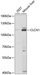 Anti-CLCN1 antibody used in Western Blot (WB). GTX32527