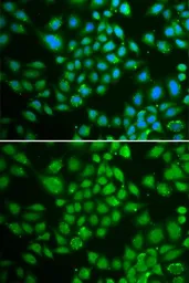 Anti-DCK antibody used in Immunocytochemistry/ Immunofluorescence (ICC/IF). GTX32553