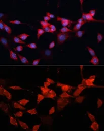 Anti-DDB1 antibody used in Immunocytochemistry/ Immunofluorescence (ICC/IF). GTX32555