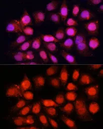 Anti-DDB1 antibody used in Immunocytochemistry/ Immunofluorescence (ICC/IF). GTX32555