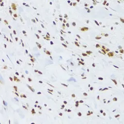 Anti-DDB1 antibody used in IHC (Paraffin sections) (IHC-P). GTX32555