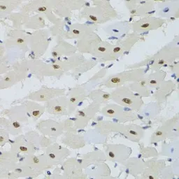 Anti-DDB1 antibody used in IHC (Paraffin sections) (IHC-P). GTX32555