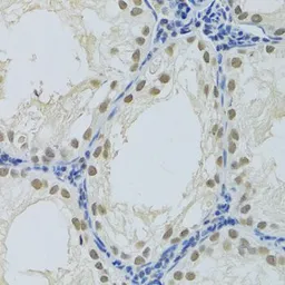 Anti-DDB1 antibody used in IHC (Paraffin sections) (IHC-P). GTX32555