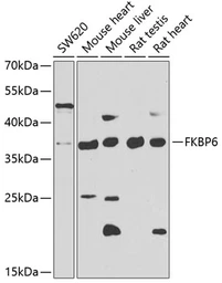 Anti-FKBP6 antibody used in Western Blot (WB). GTX32605