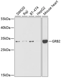 Anti-GRB2 antibody used in Western Blot (WB). GTX32632