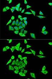 Anti-GRB2 antibody used in Immunocytochemistry/ Immunofluorescence (ICC/IF). GTX32632