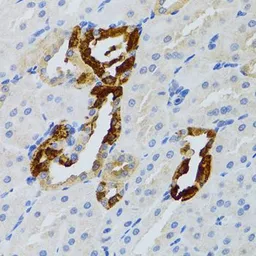 Anti-GRB2 antibody used in IHC (Paraffin sections) (IHC-P). GTX32632