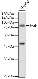 Anti-HGF antibody used in Western Blot (WB). GTX32651