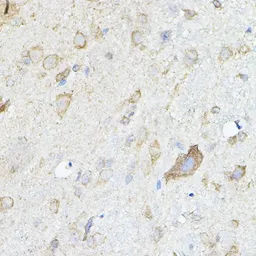 Anti-HGF antibody used in IHC (Paraffin sections) (IHC-P). GTX32651