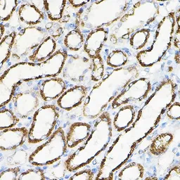 Anti-HGF antibody used in IHC (Paraffin sections) (IHC-P). GTX32651