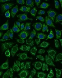 Anti-IDH2 antibody used in Immunocytochemistry/ Immunofluorescence (ICC/IF). GTX32666