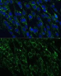 Anti-IDH2 antibody used in Immunocytochemistry/ Immunofluorescence (ICC/IF). GTX32666