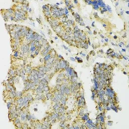 Anti-IDH2 antibody used in IHC (Paraffin sections) (IHC-P). GTX32666