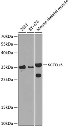 Anti-KCTD15 antibody used in Western Blot (WB). GTX32690