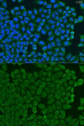 Anti-KCTD15 antibody used in Immunocytochemistry/ Immunofluorescence (ICC/IF). GTX32690