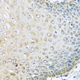 Anti-KCTD15 antibody used in IHC (Paraffin sections) (IHC-P). GTX32690