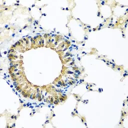 Anti-KCTD15 antibody used in IHC (Paraffin sections) (IHC-P). GTX32690