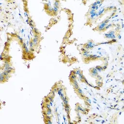 Anti-KCTD15 antibody used in IHC (Paraffin sections) (IHC-P). GTX32690