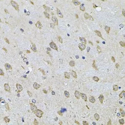 Anti-NFU1 antibody used in IHC (Paraffin sections) (IHC-P). GTX32748