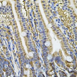 Anti-NFU1 antibody used in IHC (Paraffin sections) (IHC-P). GTX32748