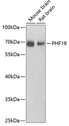 Anti-PHF19 antibody used in Western Blot (WB). GTX32787