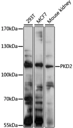 Anti-Polycystin 2 antibody used in Western Blot (WB). GTX32799