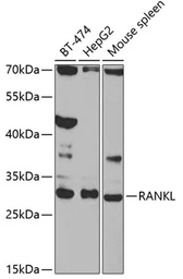 Anti-RANKL antibody used in Western Blot (WB). GTX32834