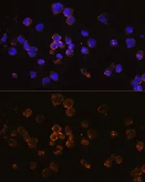 Anti-RANKL antibody used in Immunocytochemistry/ Immunofluorescence (ICC/IF). GTX32834