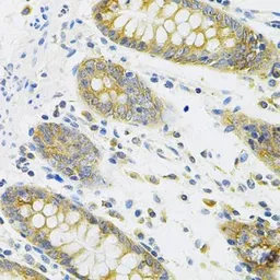 Anti-RANKL antibody used in IHC (Paraffin sections) (IHC-P). GTX32834