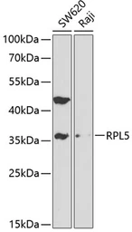 Anti-RPL5 antibody used in Western Blot (WB). GTX32848