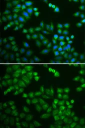 Anti-RPL5 antibody used in Immunocytochemistry/ Immunofluorescence (ICC/IF). GTX32848