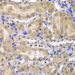 Anti-RPL5 antibody used in IHC (Paraffin sections) (IHC-P). GTX32848