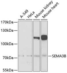 Anti-SEMA3B antibody used in Western Blot (WB). GTX32864