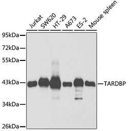 Anti-TDP43 antibody used in Western Blot (WB). GTX32912