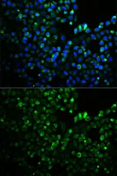 Anti-UGDH antibody used in Immunocytochemistry/ Immunofluorescence (ICC/IF). GTX32948