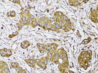 Anti-UGDH antibody used in IHC (Paraffin sections) (IHC-P). GTX32948