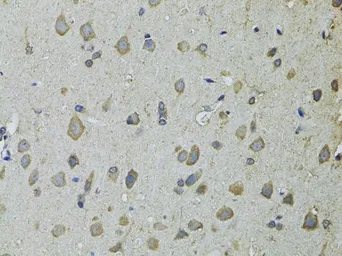 Anti-UGDH antibody used in IHC (Paraffin sections) (IHC-P). GTX32948