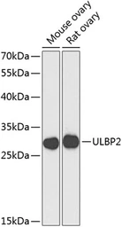 Anti-ULBP2 antibody used in Western Blot (WB). GTX32953